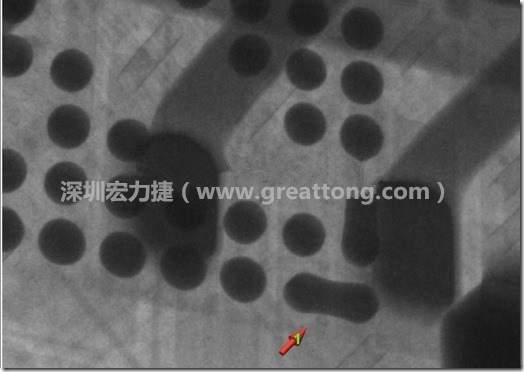 BGA因為焊墊變小，造成錫膏過多而最終形成焊接短路的結果。